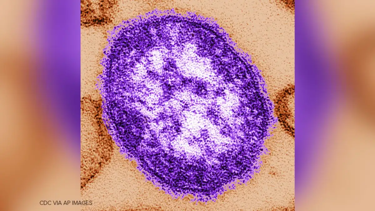 Fourth measles case confirmed in L.A. County; person visited LAX, restaurants while infectious - 1