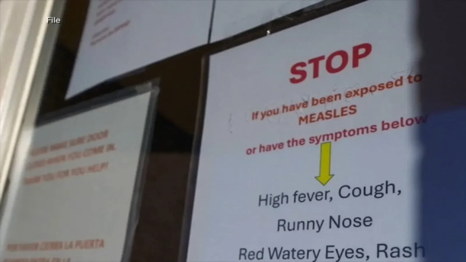 Wake County Measles Outbreak: First Signs, Risk Factors, Places to Avoid as Authorities Flag Several Areas - 1