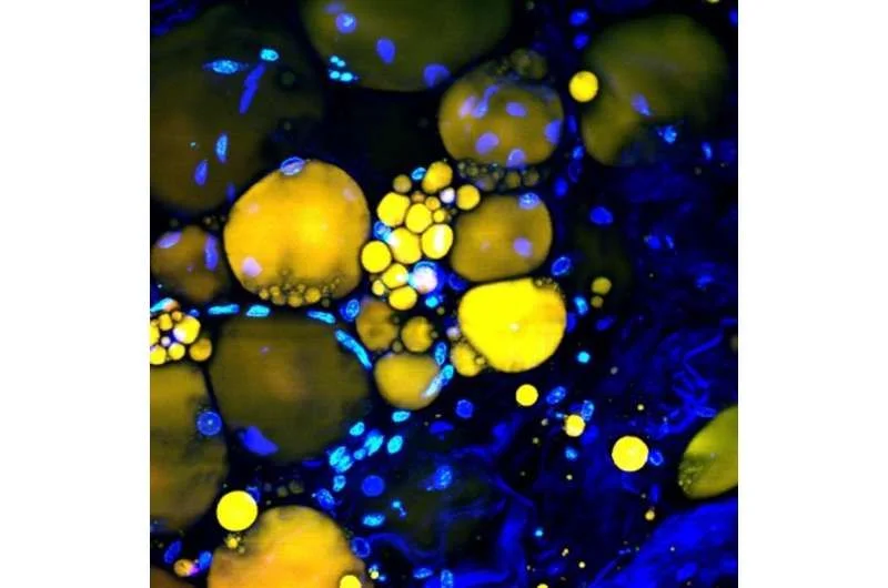 Tiny flexible lasers enable force sensing inside living cells - 4