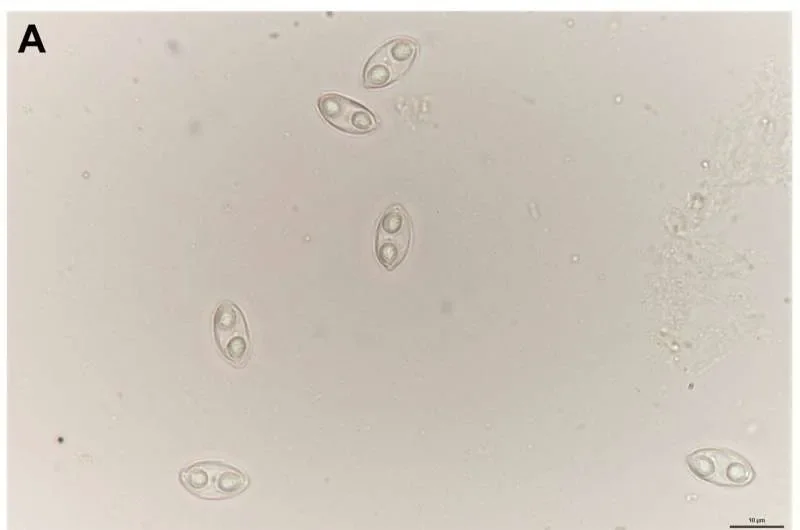 Scientists uncover hidden parasite diversity in barb fish from the Sea of Galilee - 3