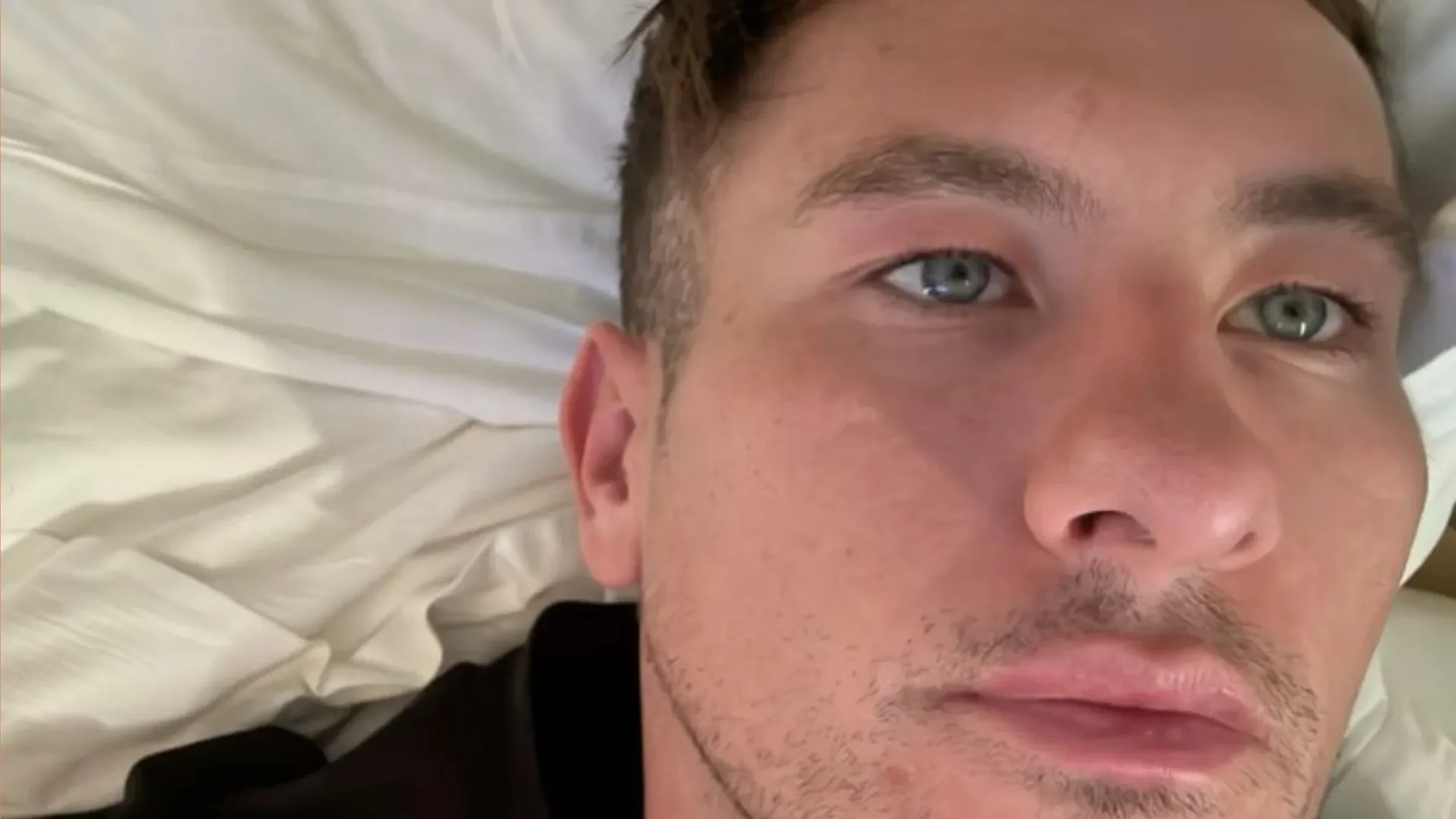 10 Photos of Barry Keoghan as He Reveals Online Abuse Over His Looks Is So Bad He 'No Longer Wants to Go Outside' - 1