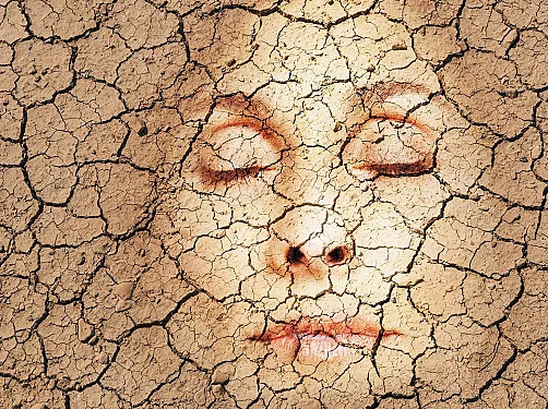 Winter can make this common female condition worse – here's how to protect yourself - 3