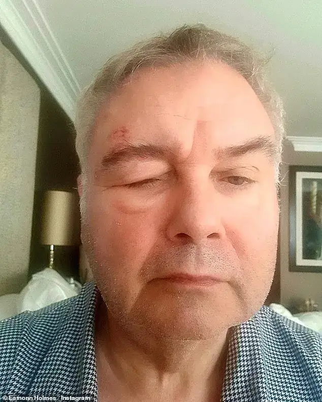 Eamonn Holmes is rushed to hospital after suffering a suspected stroke in latest health battle - 4