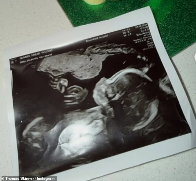 Thomas Skinner announces wife Sinead is pregnant with their fourth child in sweet post - months after his Strictly 'affair' scandal and claims show bosses 'rigged' the public vote - 2