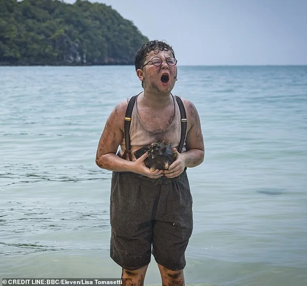 Lord of the Flies star reveals he has kidneys from both parents - 2