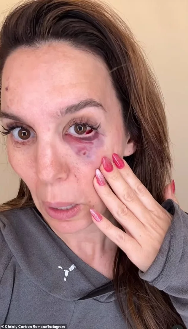 What Kind of Cancer Does Christy Romano Have? Inside the Former Disney Star's Health Scare - 2