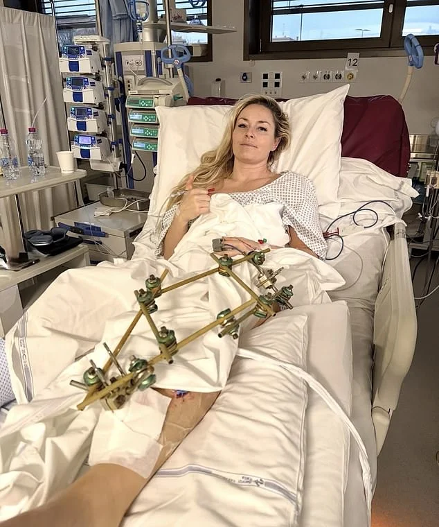 Lindsey Vonn shares nervous post as she awaits fifth surgery on broken leg after Olympic fall and dog's death - 2