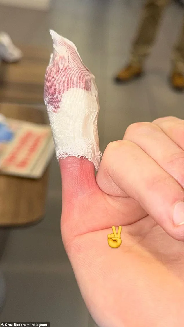 Cruz Beckham cuts off pinky in grisly accident shared by Victoria Beckham - 4