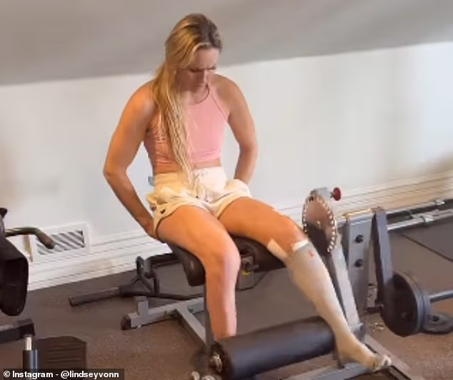Lindsey Vonn pushes through pain in inspiring recovery video after Olympic setback - 2