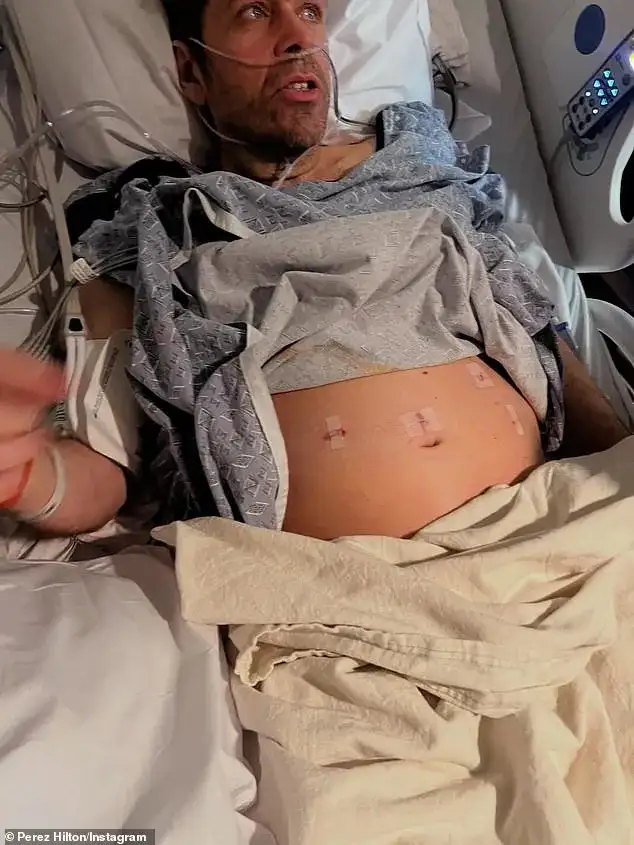 Frail Perez Hilton reveals mystery health crisis that left him hospitalized - 2