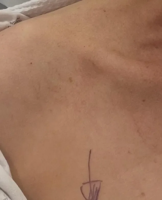 Ricky Gervais' partner Jane Fallon shares a positive health update following surgery after being diagnosed with breast cancer - 2