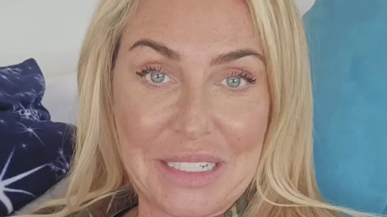 Josie Gibson reveals she had 45 per cent of her arm removed in liposuction surgery amid lipoedema battle - 4