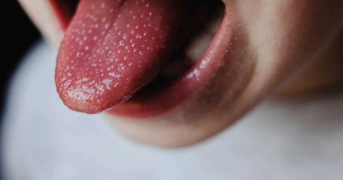 Symptoms as UKHSA warns infectious illness 'can become serious' - 3