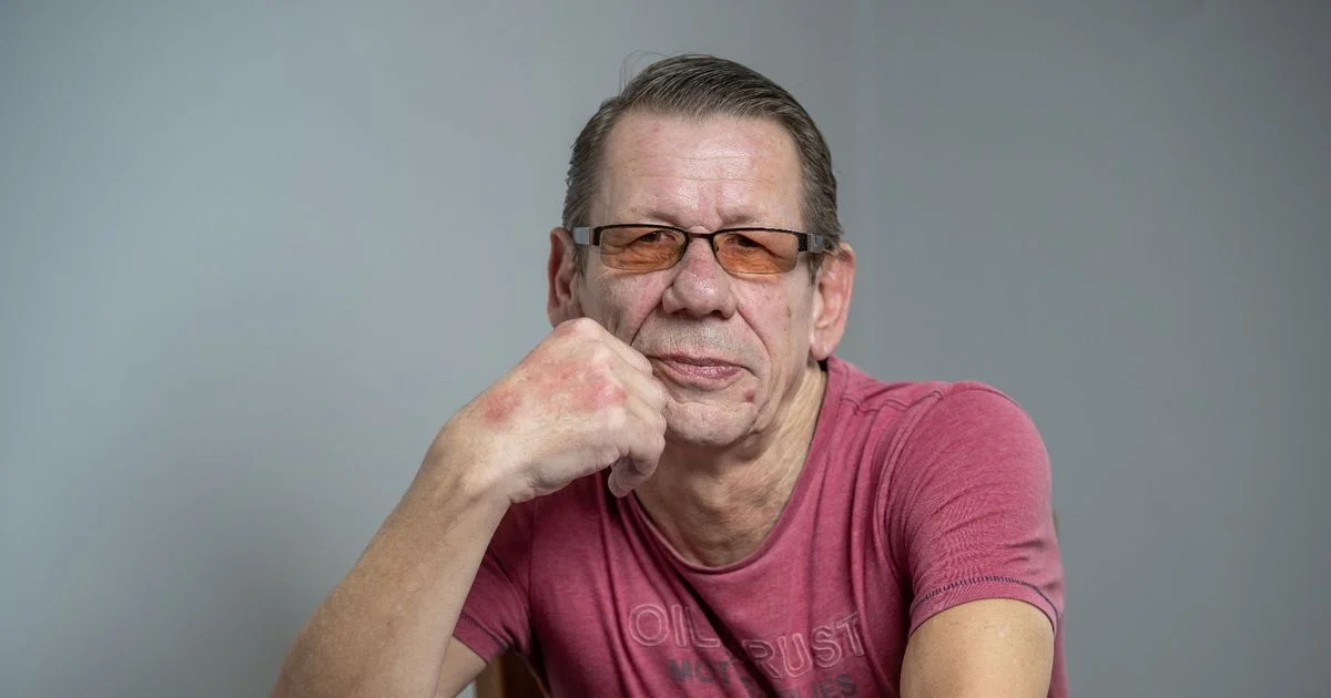 Man who couldn't get NHS space takes 14 trains and buses to Turkey for dentist - 3