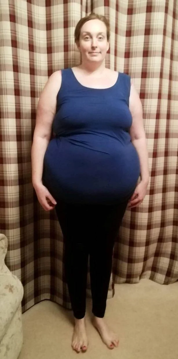 Mother loses 12 stone without fat jabs after being escorted off of Alton Towers ride because she was too heavy - 3