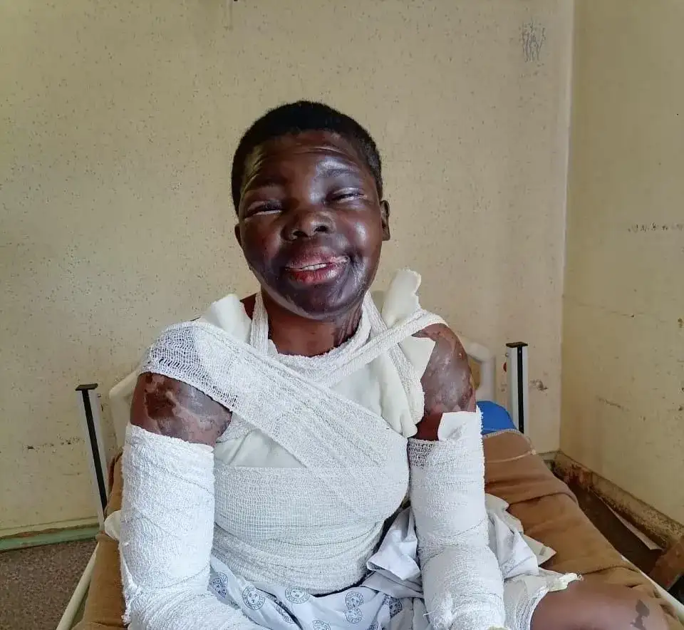 Jealous ex-boyfriend accused of ‘vicious’ acid attack that left college student severely burned: DA - 2