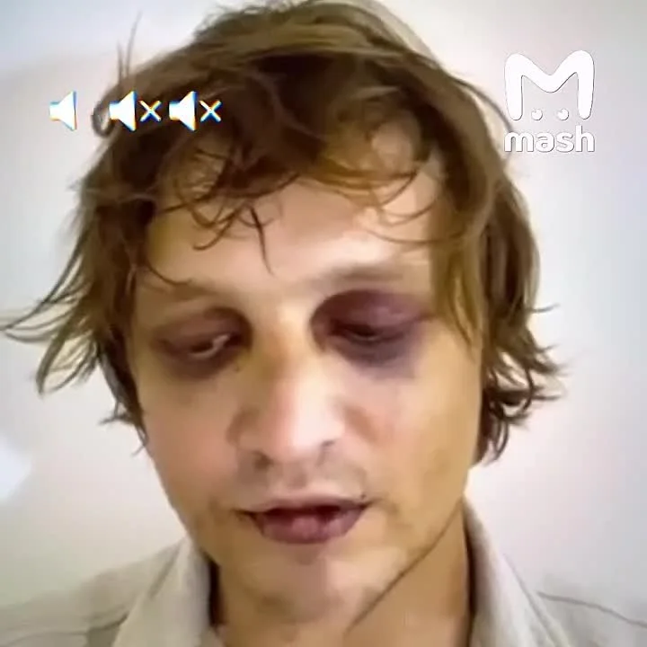 Who Is Igor Komarov? Son of Ukrainian Crime Figure Abducted in Bali With a $10M Ransom Demand - 4