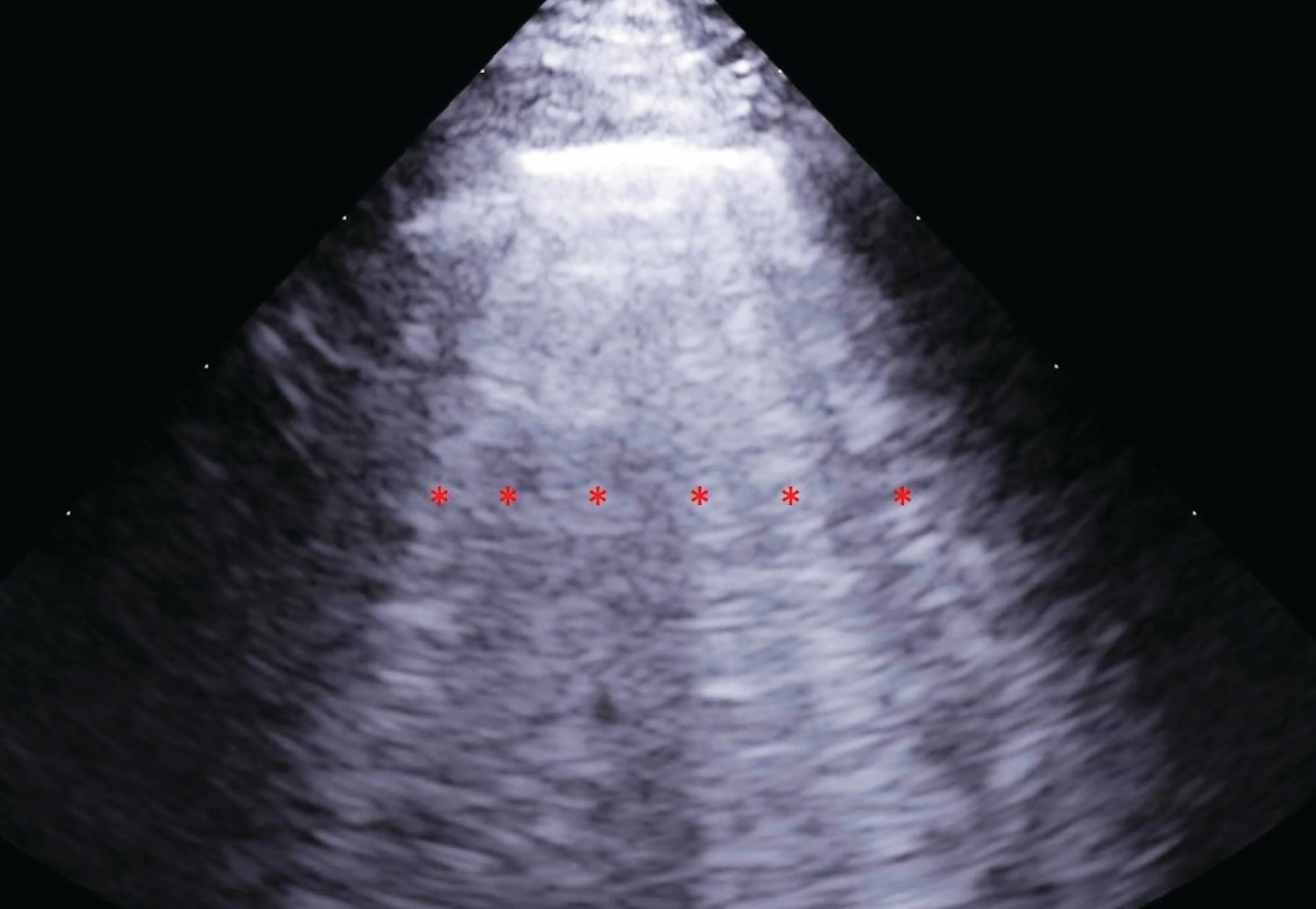 Can human heart failure interventions work in dogs? - 1