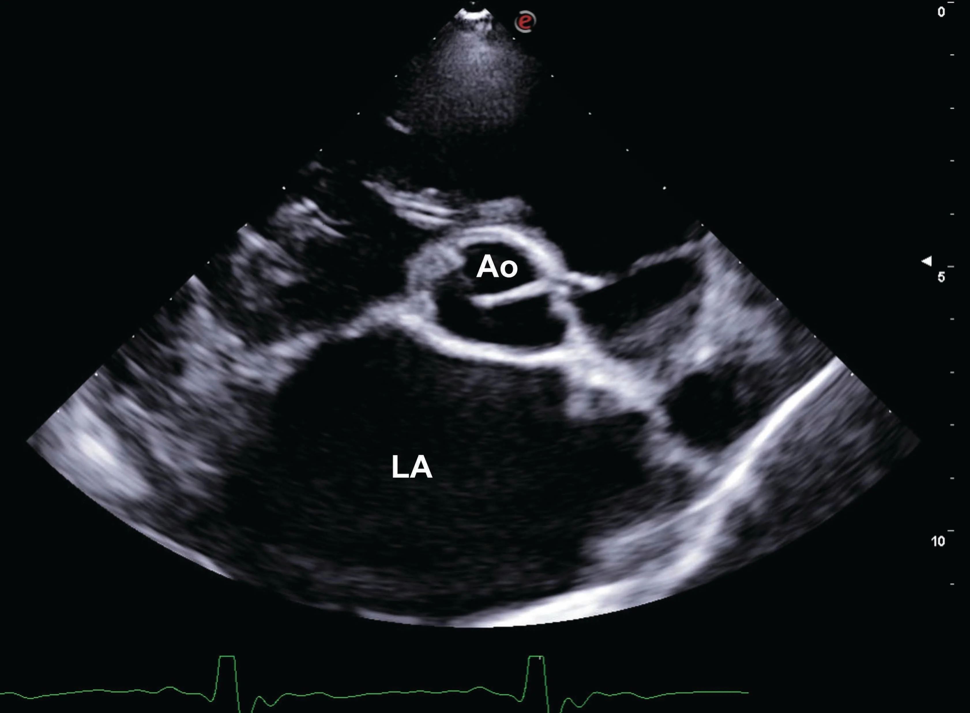 Can human heart failure interventions work in dogs? - 2