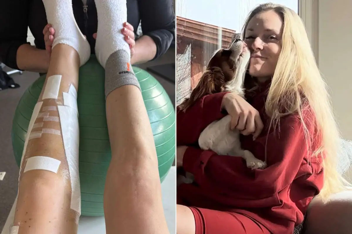 Lindsey Vonn Battles Back From Olympic Injuries Amid Personal Heartbreak - 1