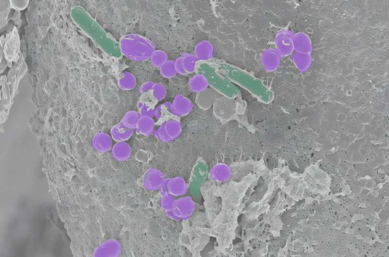 Scientists find a new clue to help them identify a healthy gut microbiome - 1