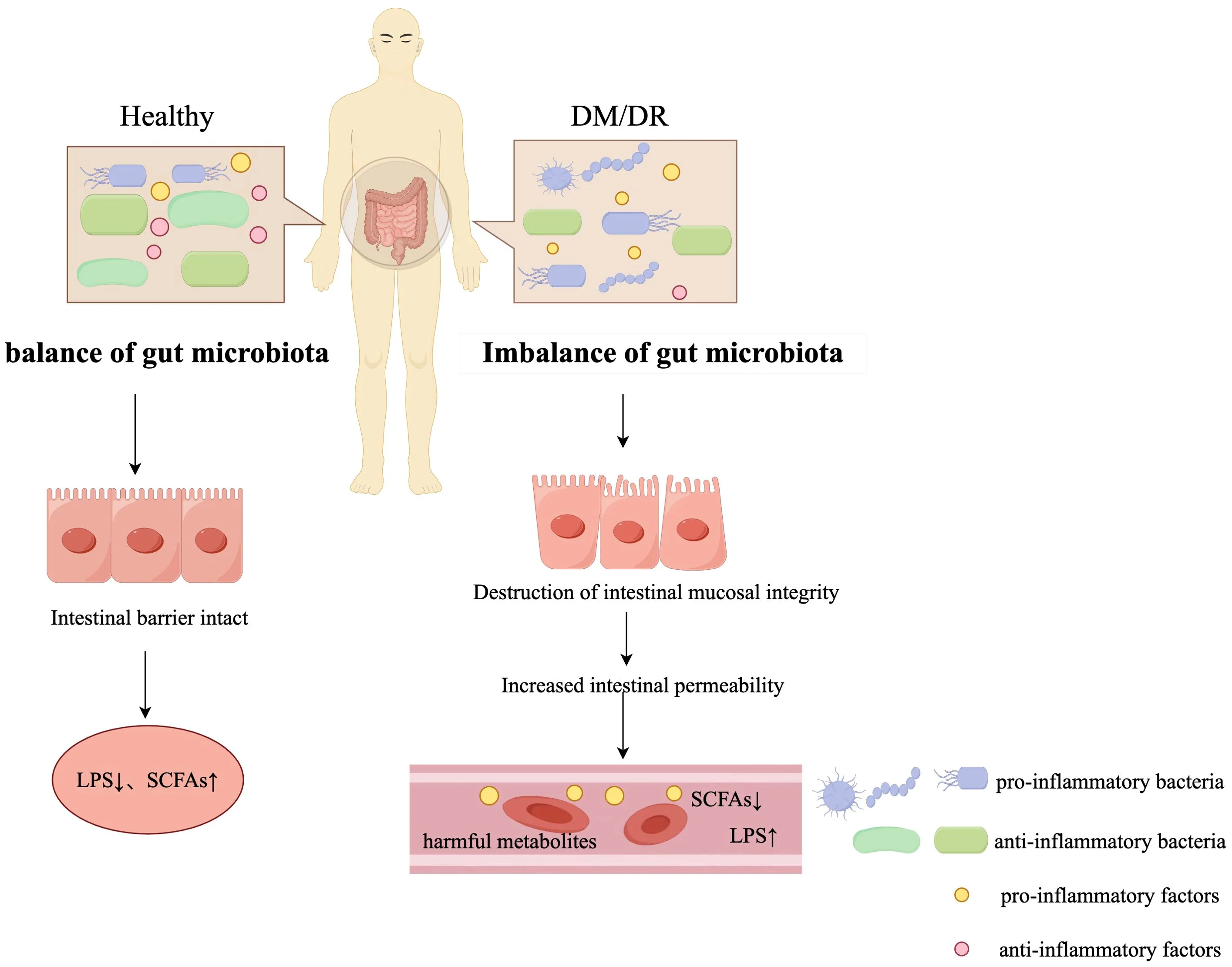 Gut Microbiota Dysbiosis is a Factor in Diabetic Retinopathy - European Medical Journal - 2