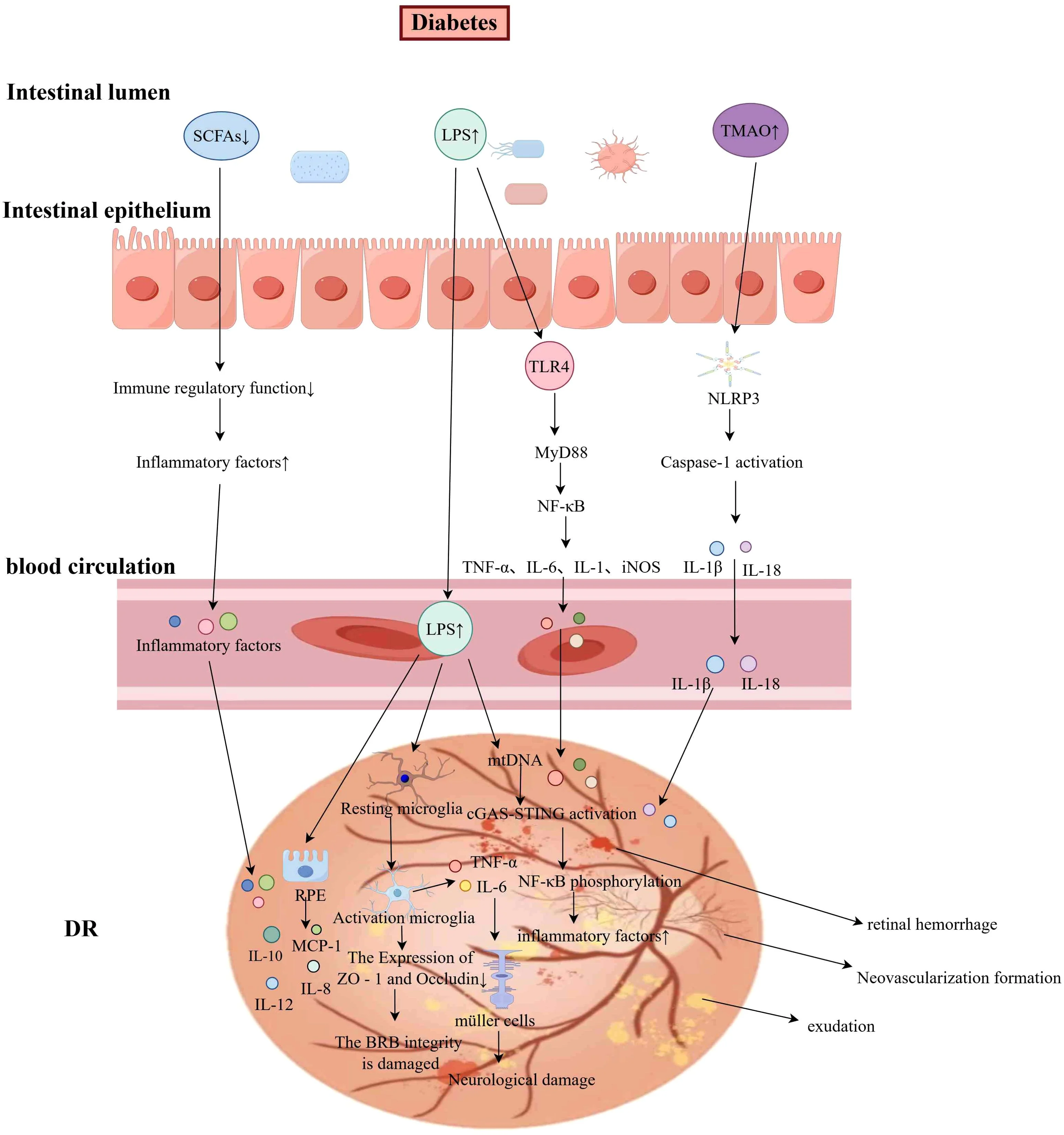 Gut Microbiota Dysbiosis is a Factor in Diabetic Retinopathy - European Medical Journal - 1